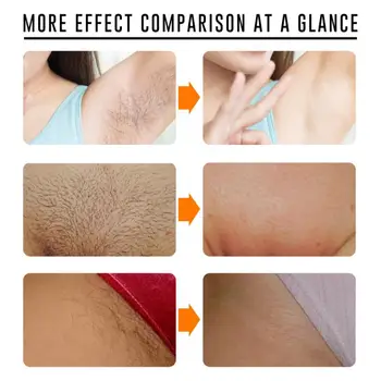 Creme de depilação Indolor Pele Normal Removedor do Cabelo De Axila, Pernas e Braços em Pele Creme Depilatório Para Homens Mulheres