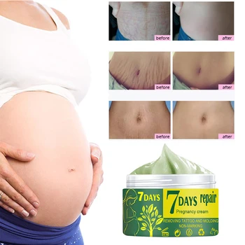 Remoção De Gravidez Cicatrizes Creme De Tratamento De Estrias Maternidade Corpo Reparação Hidratante Firmador Mulheres De Cuidados Da Pele Creme